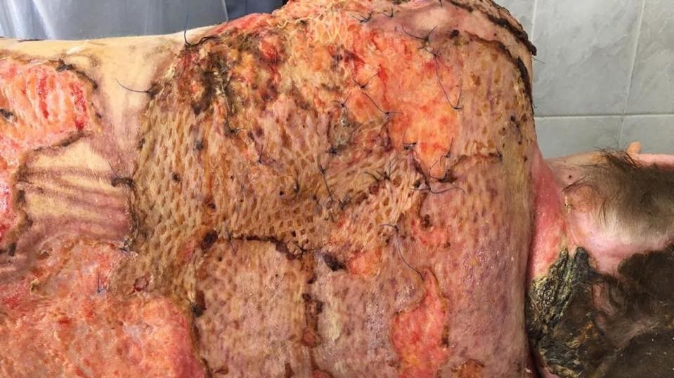 Перегляд не рекомендовано особам з чутливою психікою, вагітним жінкам і дітям