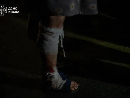 У Києві внаслідок нічної атаки постраждали люди: фото та відео наслідків